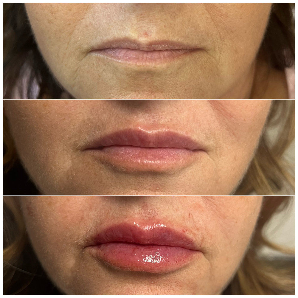 1ml Lip TouchUp