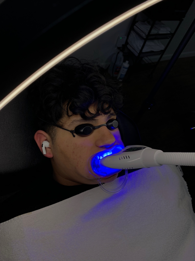 Cosmentic Teeth Whitening