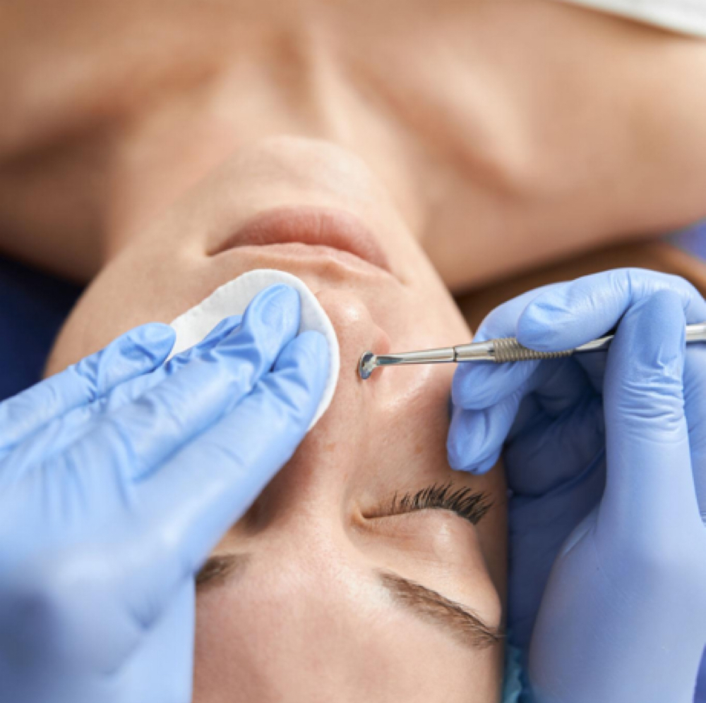 Clarifying Acne Facial at Truly Pampered Salon & Day Spa in Brockport, NY