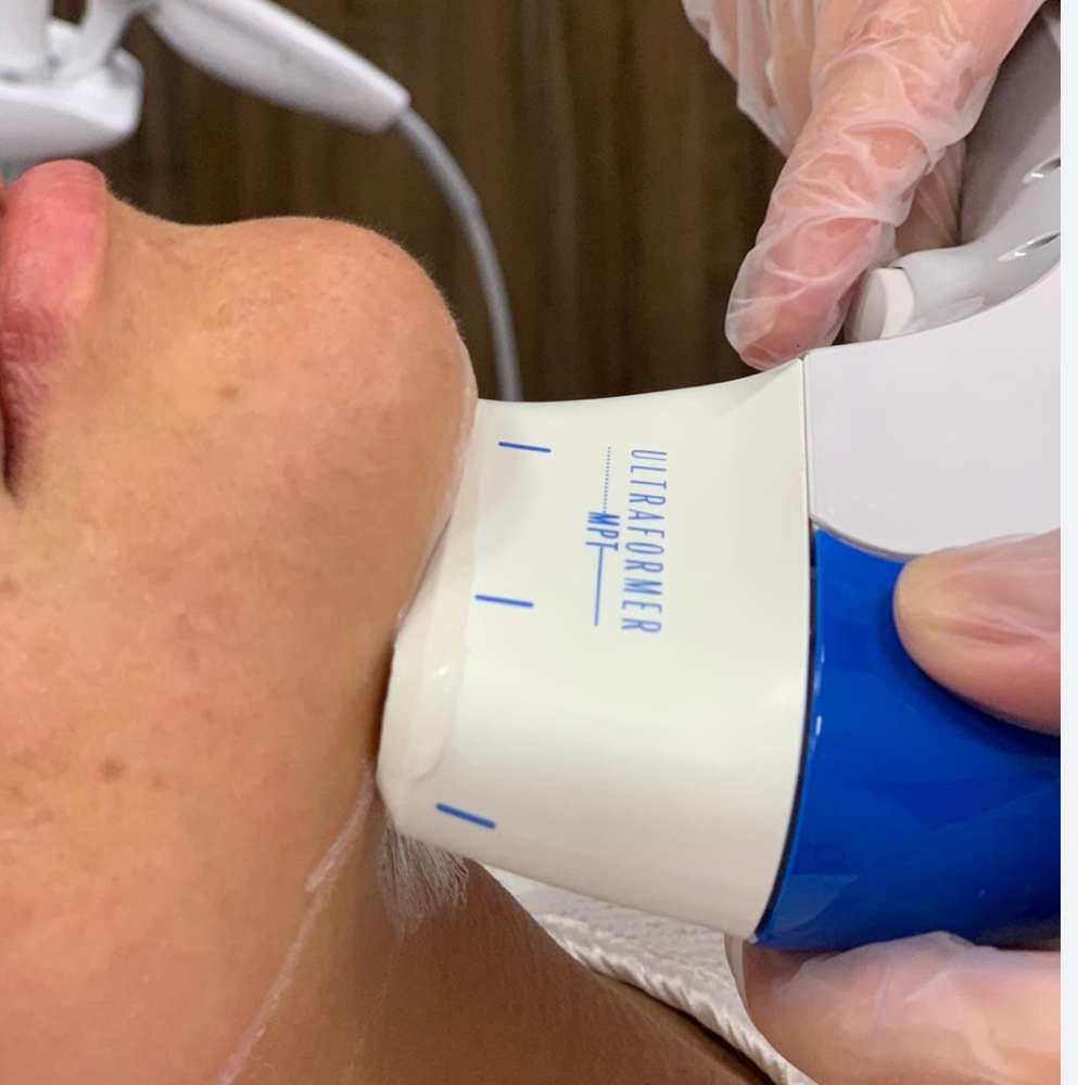 HIFU/ ULTRAFORMER MPT