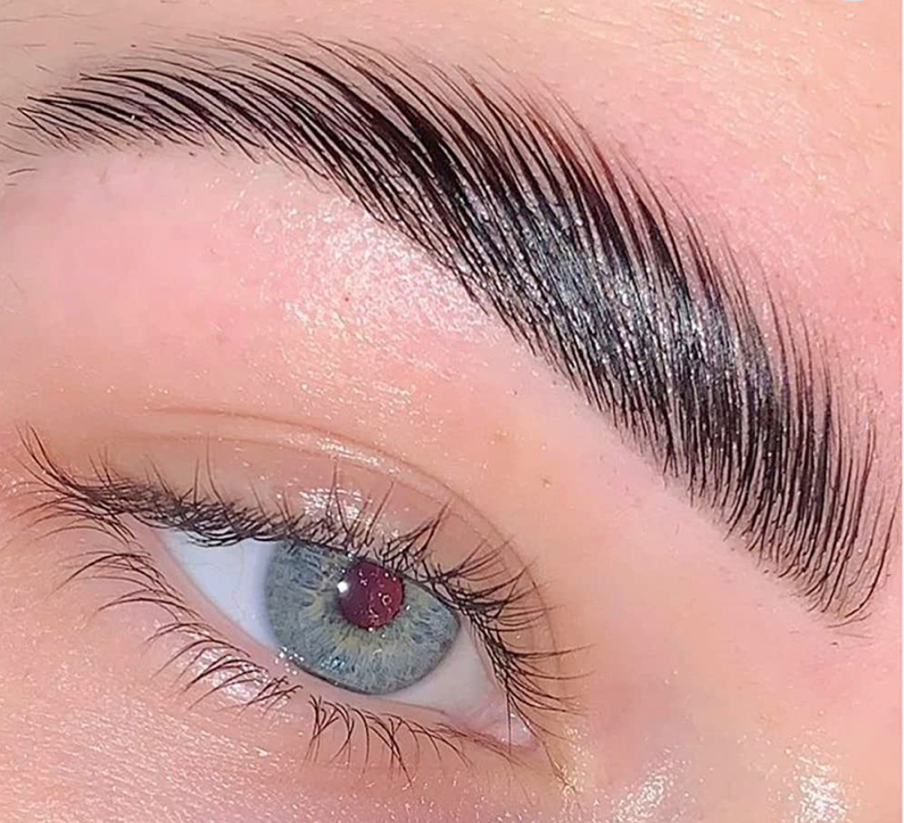 BROW TRANSFORMATION