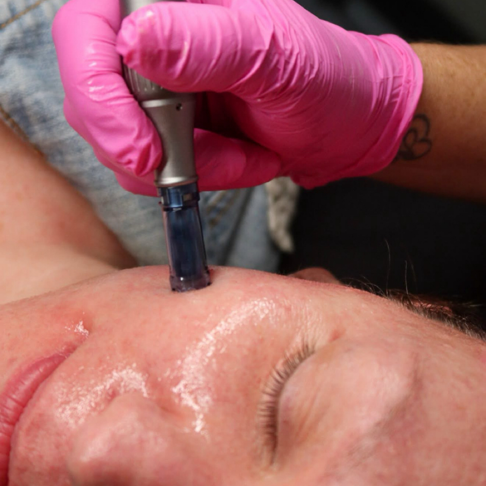 Microneedling Facial at Simply A Hair Bar & Spa in Shelby, NC