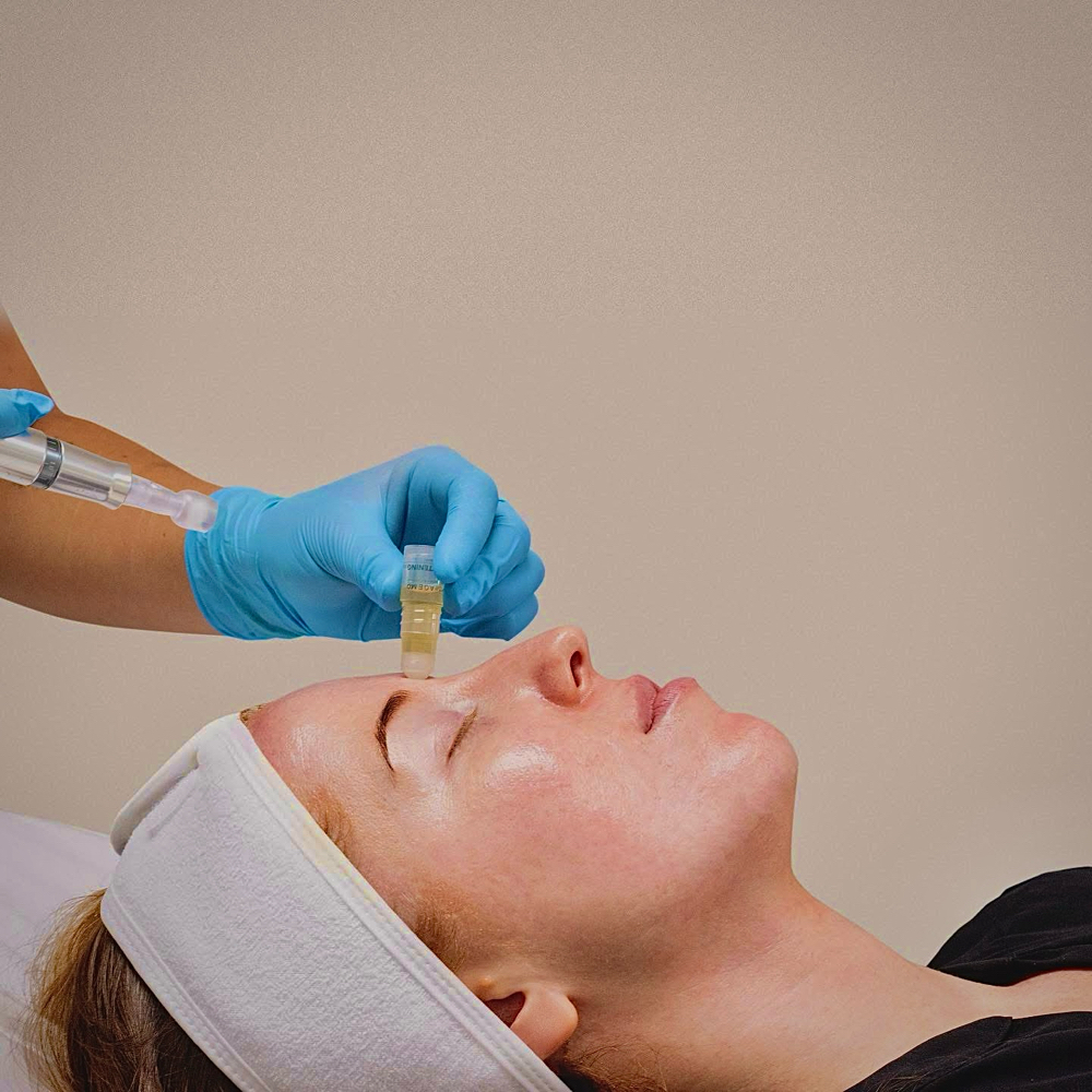 Stem Cell Infusion for Members at Skin Care by Kayla in Martinez, GA