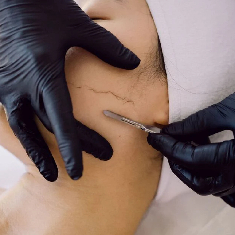 Add On Dermaplane at SOL SKN Aesthetics in Franklin, TN