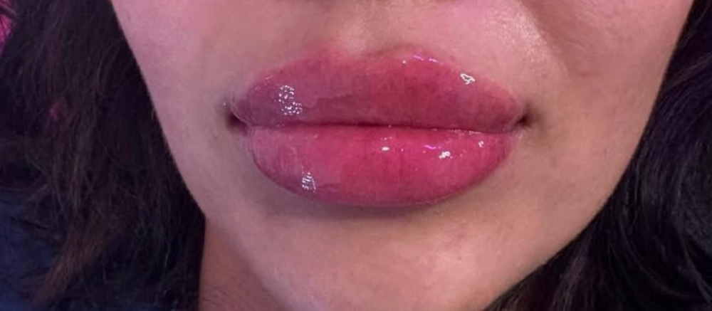 Bratz Lipsđź‘„ at Bliss by criss llc in Buda, TX