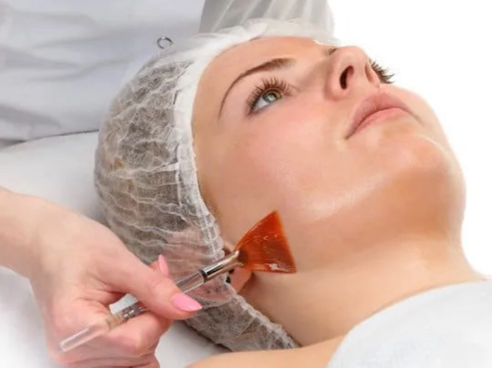 September 8 Week Peel Series