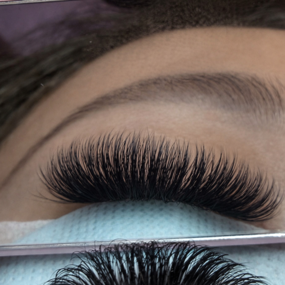 Volume Fill In at Karma Beauty Spa in Plymouth, MI