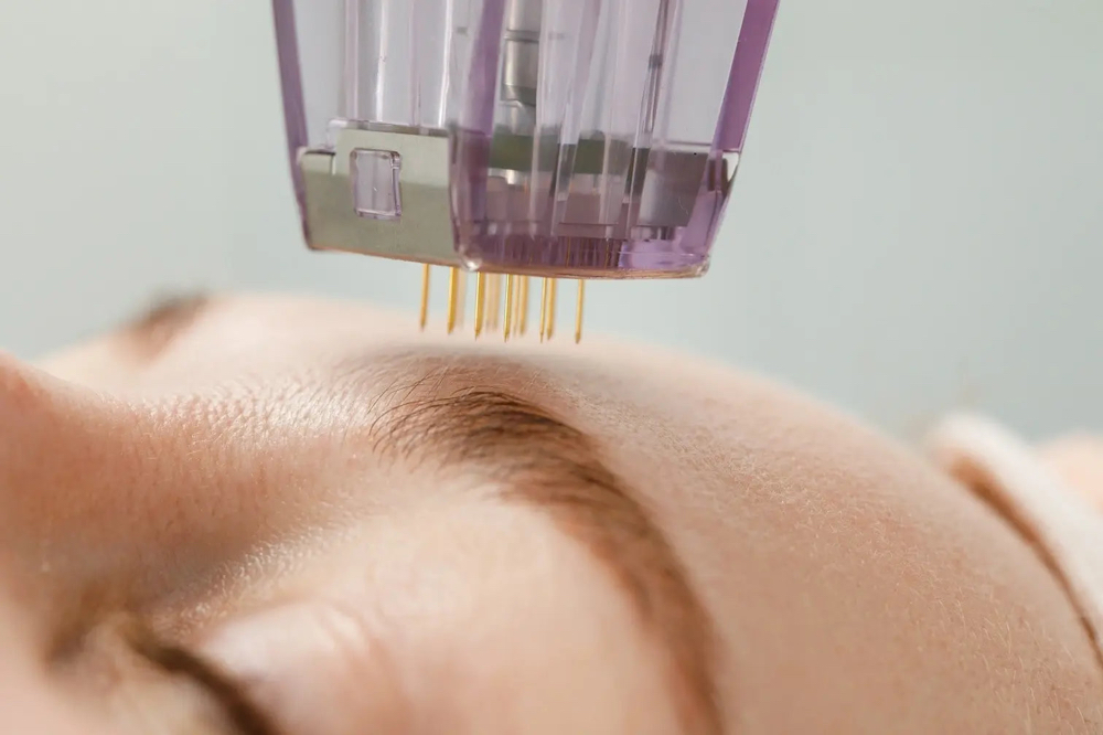 Vivace Face, Neck And Chest