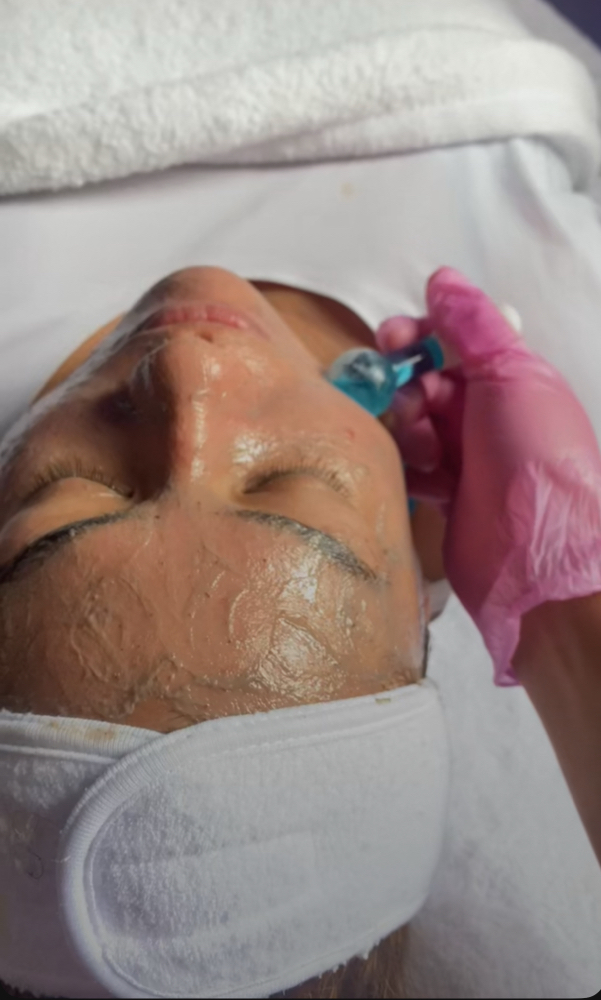 HydroGold Facial