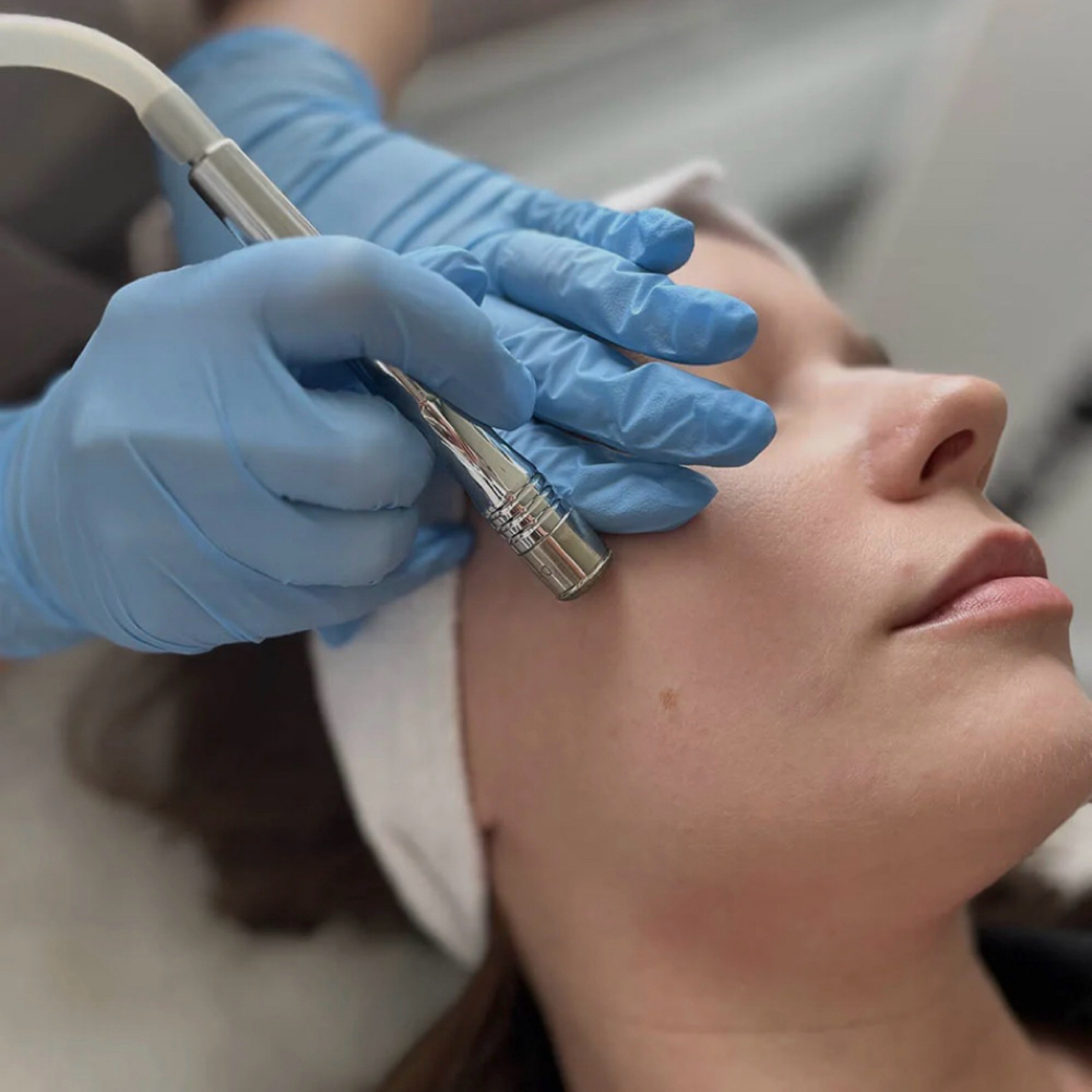 Diamond Microdermabrasion at SH Lash Beauty in Beverly Hills, CA