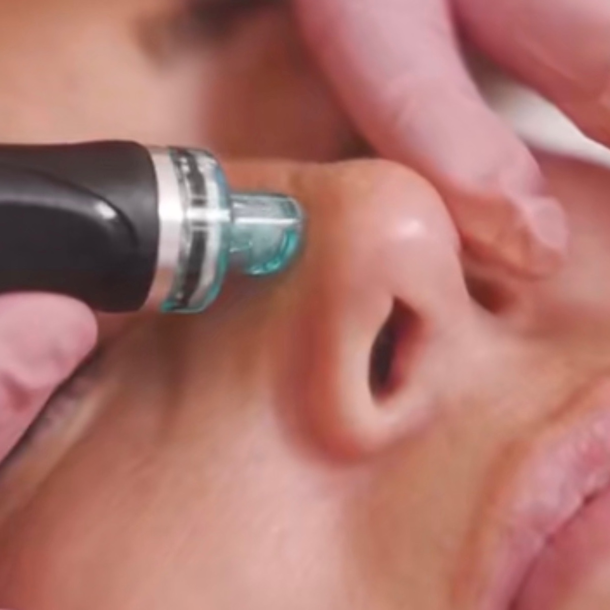 the deluxe hydrafacial at 828aesthetics in Henderson, NV