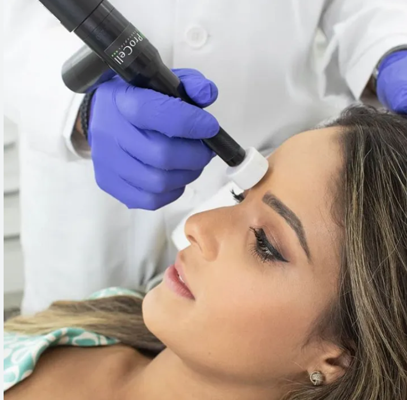 ProCell Microneedling