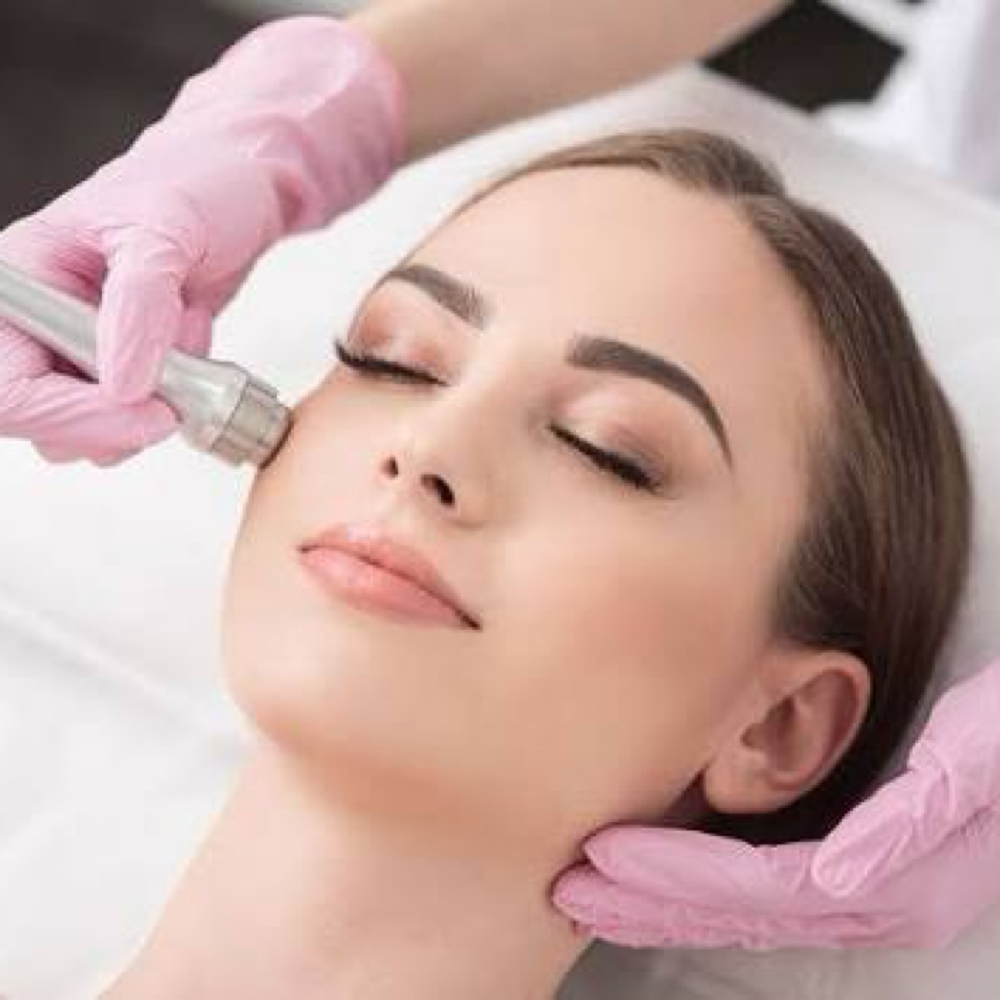 Microdermabrasion at Peachy Queen Waxing Lounge in Aurora, CO