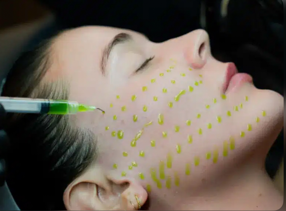 Dermaclean Acne Treatment