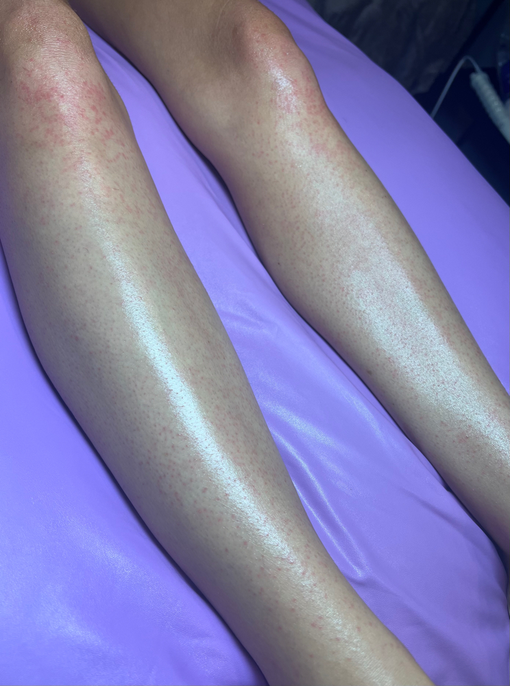 Full Legs at Raine Esthetics in Pendleton, IN