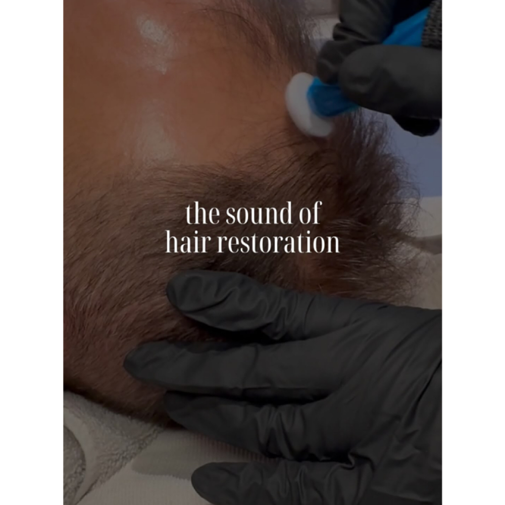 Hair Folicle Rejuvenation at Millennium Day Spa in Inglewood, CA