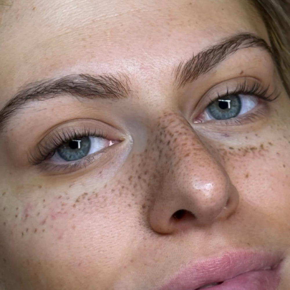 Hyperrealistic Freckles at Inked Beauty by Tyler Rose in Shirley, NY