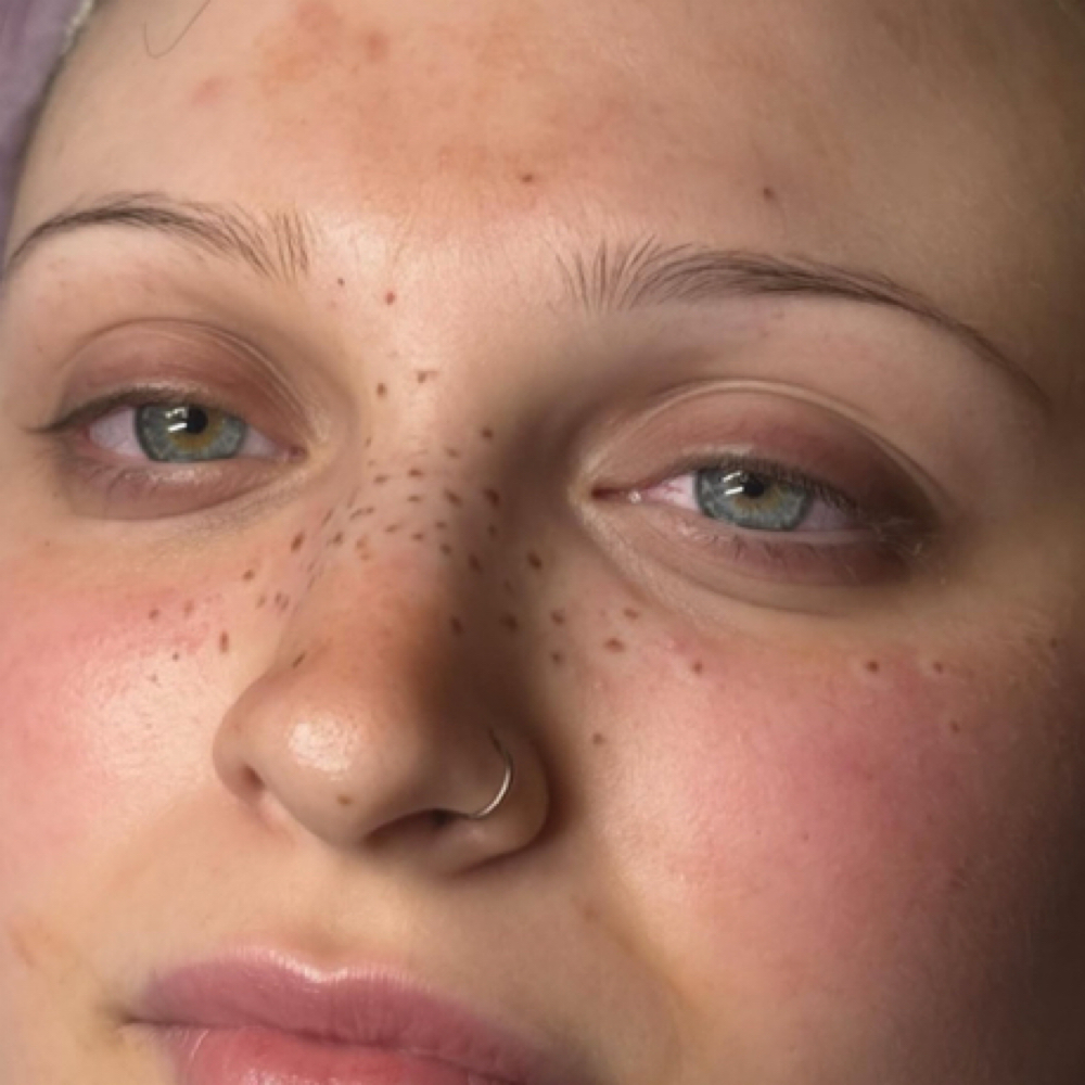 Freckles at Inked Beauty by Tyler Rose in St James, NY