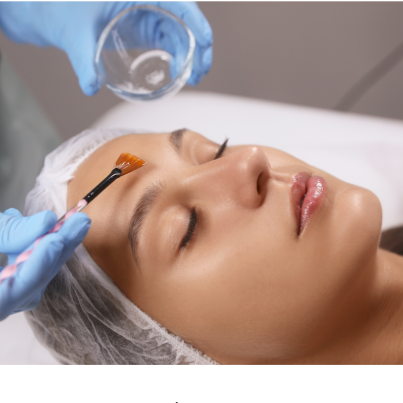 Chemical Peel at Rei’A Esthetics in Yonkers, NY