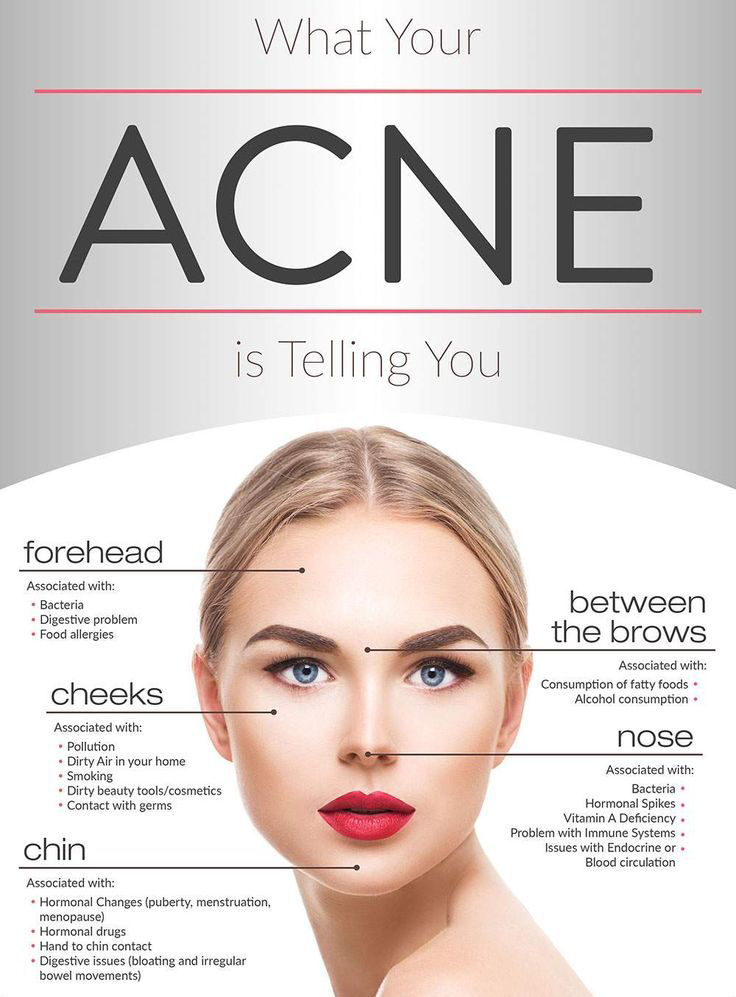 Acne Treatment Facials