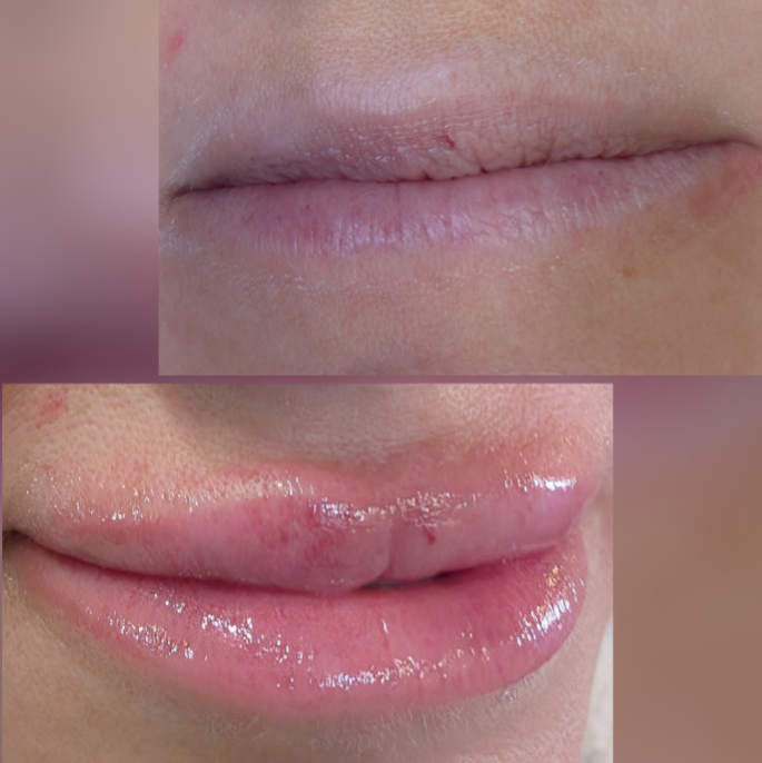Lip Blushing Touch-up