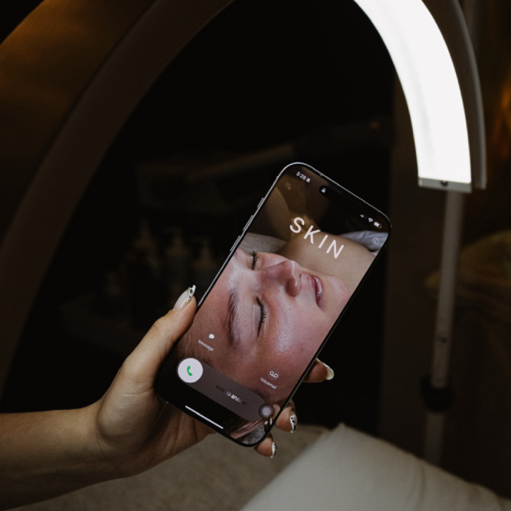 V Microchanneling Package