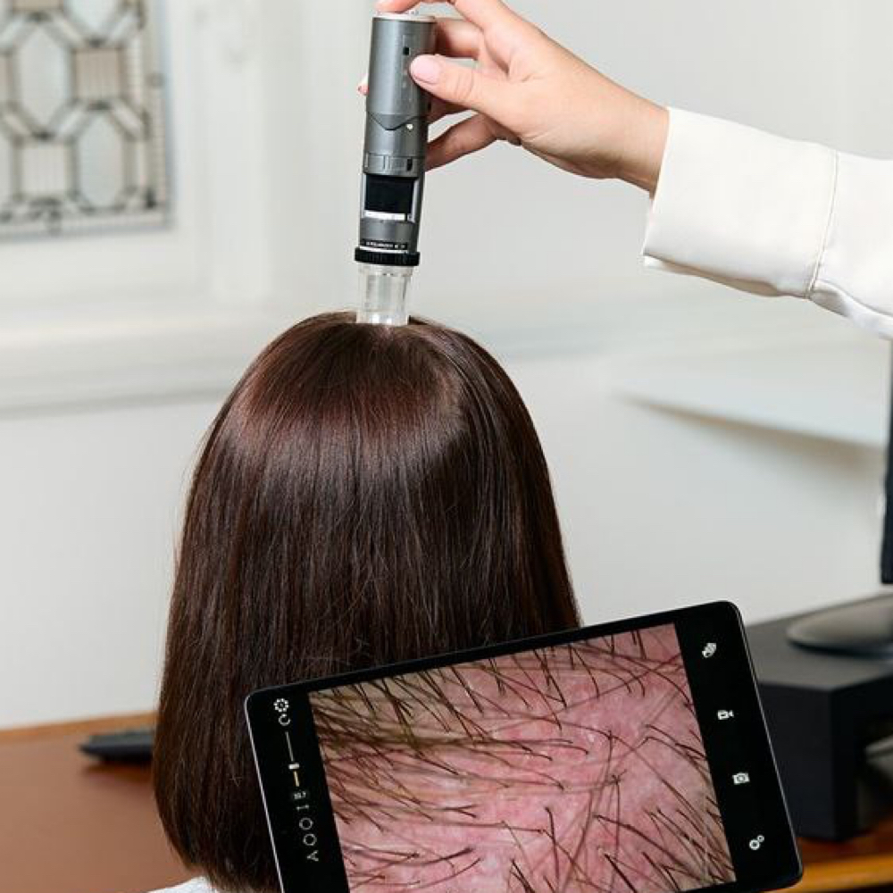 Hair & Scalp Analysis at 4U Body&Skin in Holland, PA
