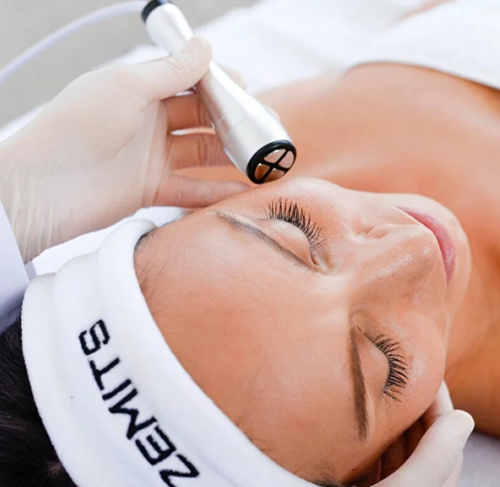 RF Skin Tightening (Face)