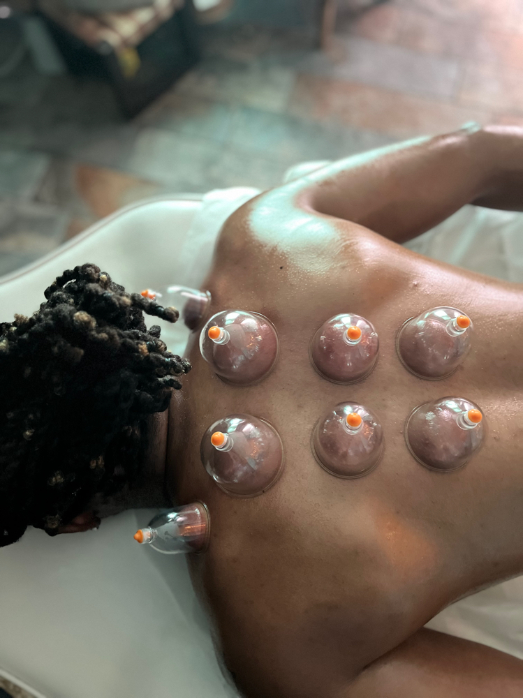 Cupping Therapy