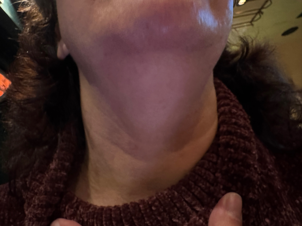 Chin And Neck Wax at Lisa -Skin-Therapy in Fresno, CA