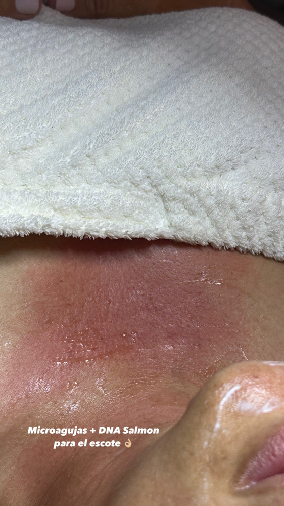 Collagen & Brightening Facial at Naked Skin Studio in Las Piedra, PR