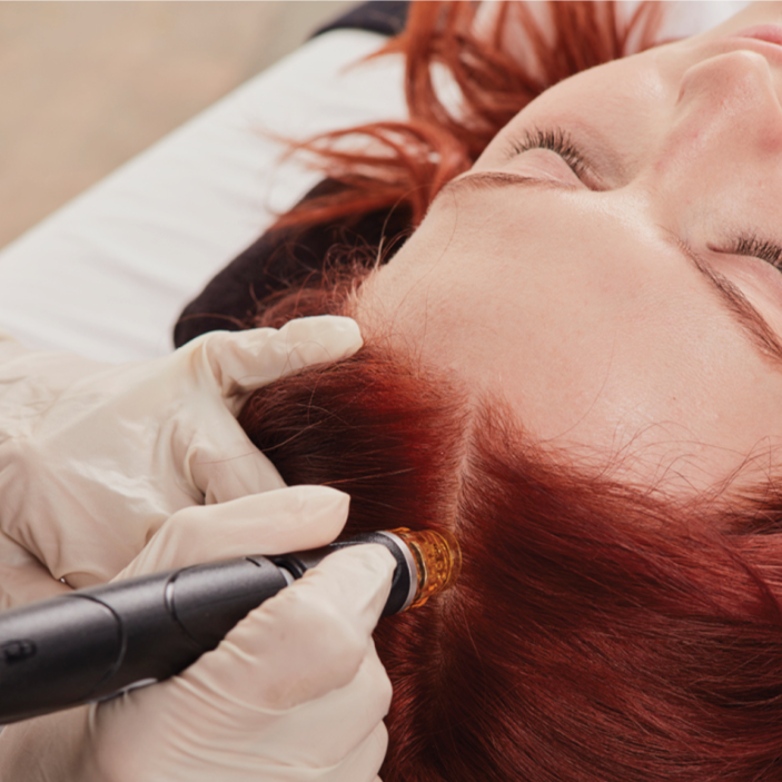 Keravive Partial Scalp Treatment at Bear Skin Med Spa in Huntersville, NC