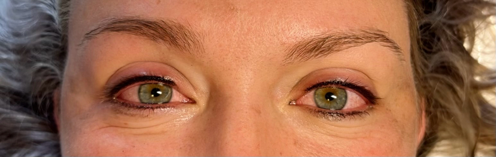 Lash Enhancment