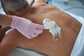 Customized Back Acne Treatment