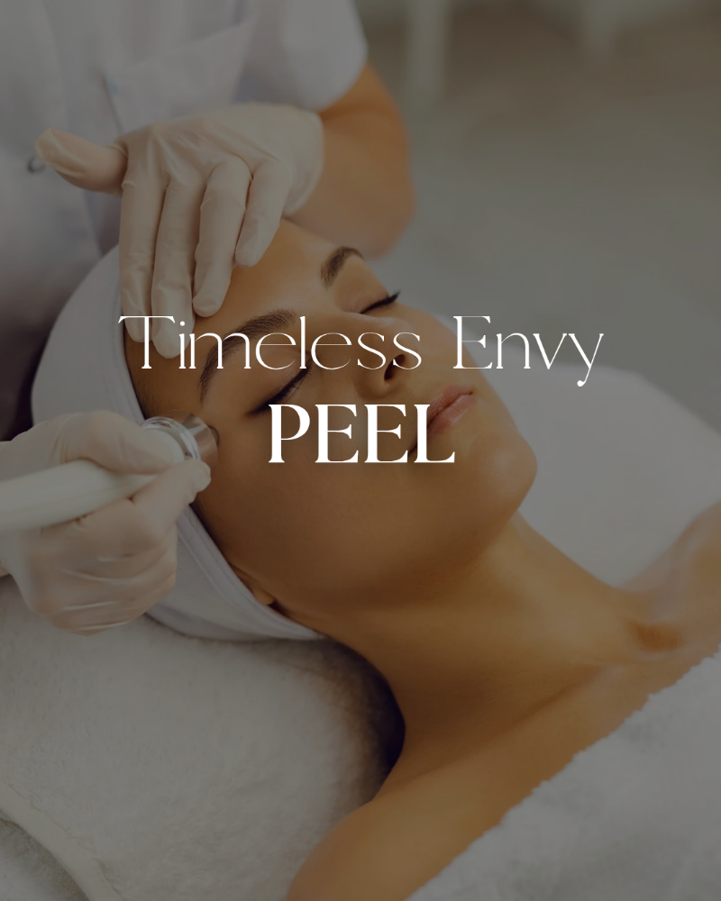 Timeless Envy PCA Peel