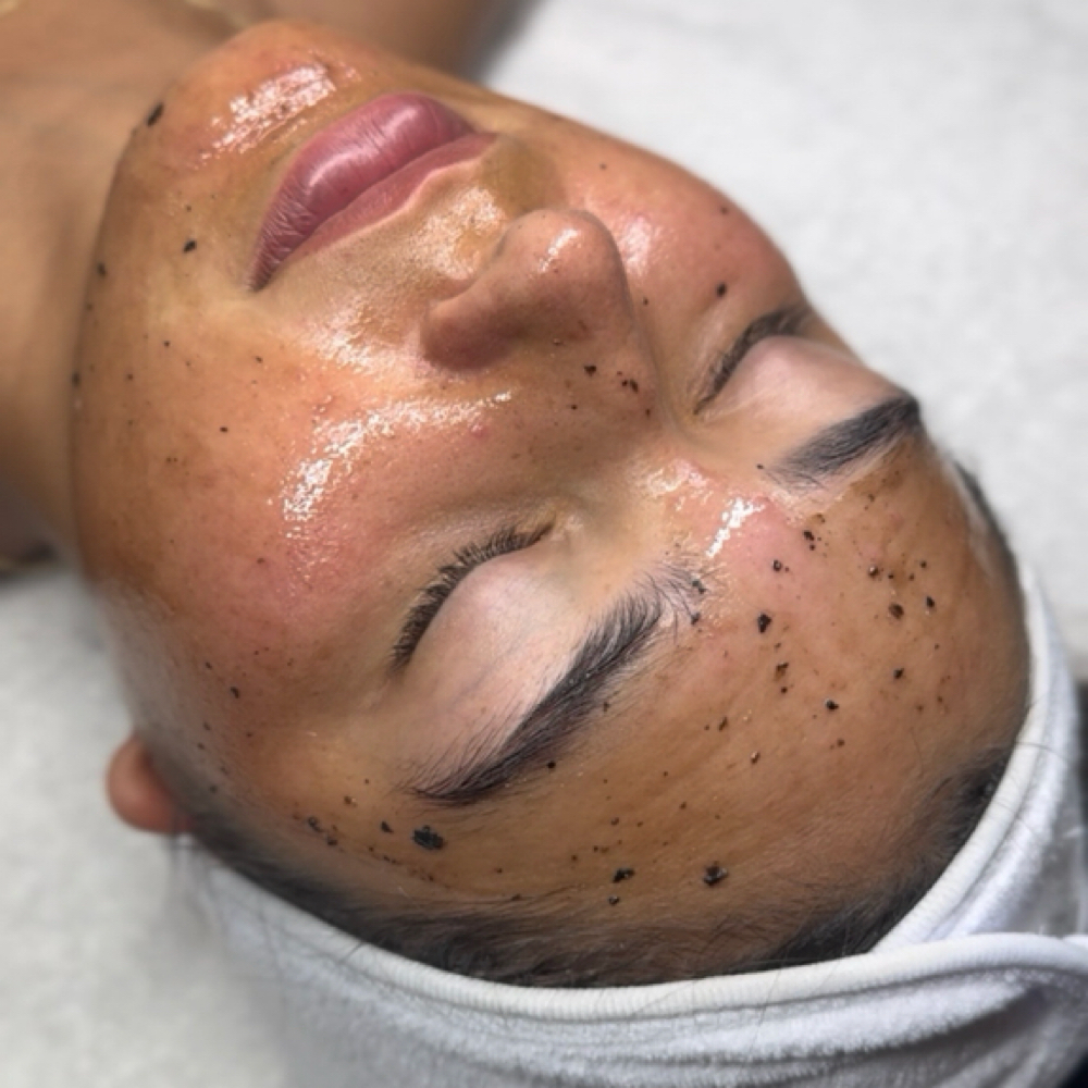 Enzyme Peel at Luxe Complexion Aesthetics in Jupiter, FL