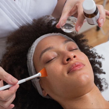 Smooth & Bright Peel Treatment at The Skn Lab in Menifee, CA