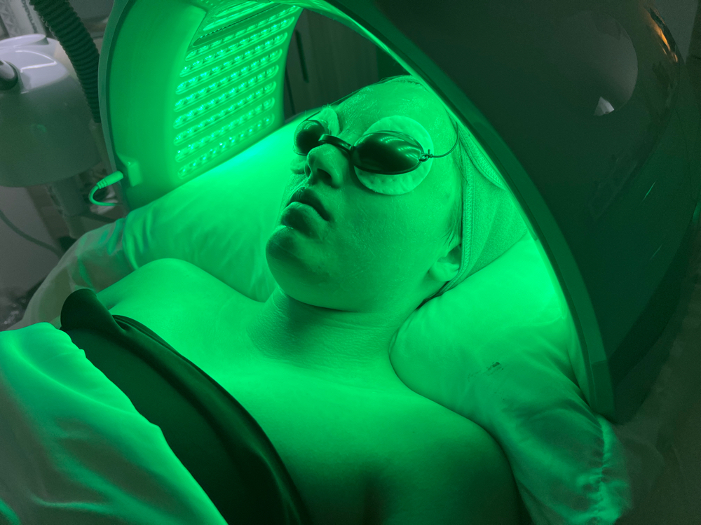 Turbo Acne Facial - 30 minute at SECRET SKIN in Santa Rosa, CA