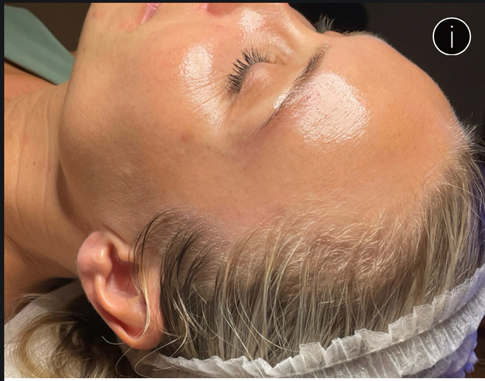 60 MINUTE HYDROFACIAL & DERMAPLANE