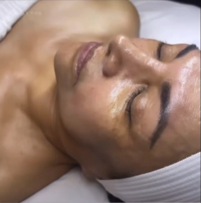 Level 1 Exfoliation Peel