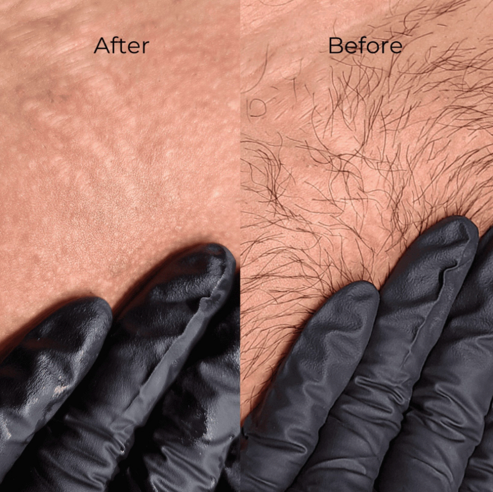 Brazilian Wax at Transformed Beauty in Leomister, MA