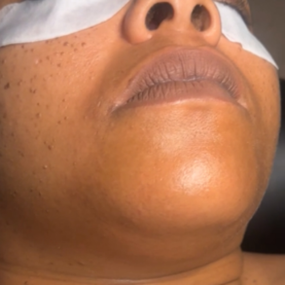 Chin Wax at Beyond Esthetics Studio in Brandon, FL