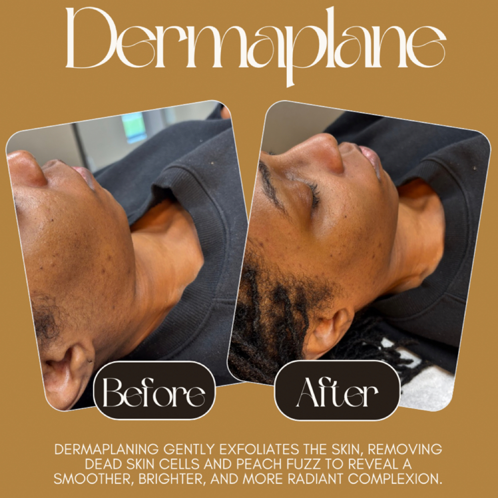 Dermaplane | Add On at Sevenity Bodyworks in Augusta, GA