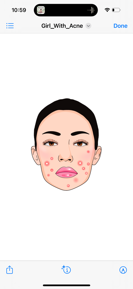 Acne Facial