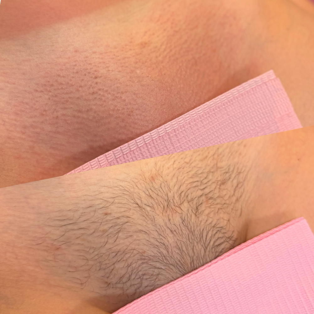 Bikini Wax