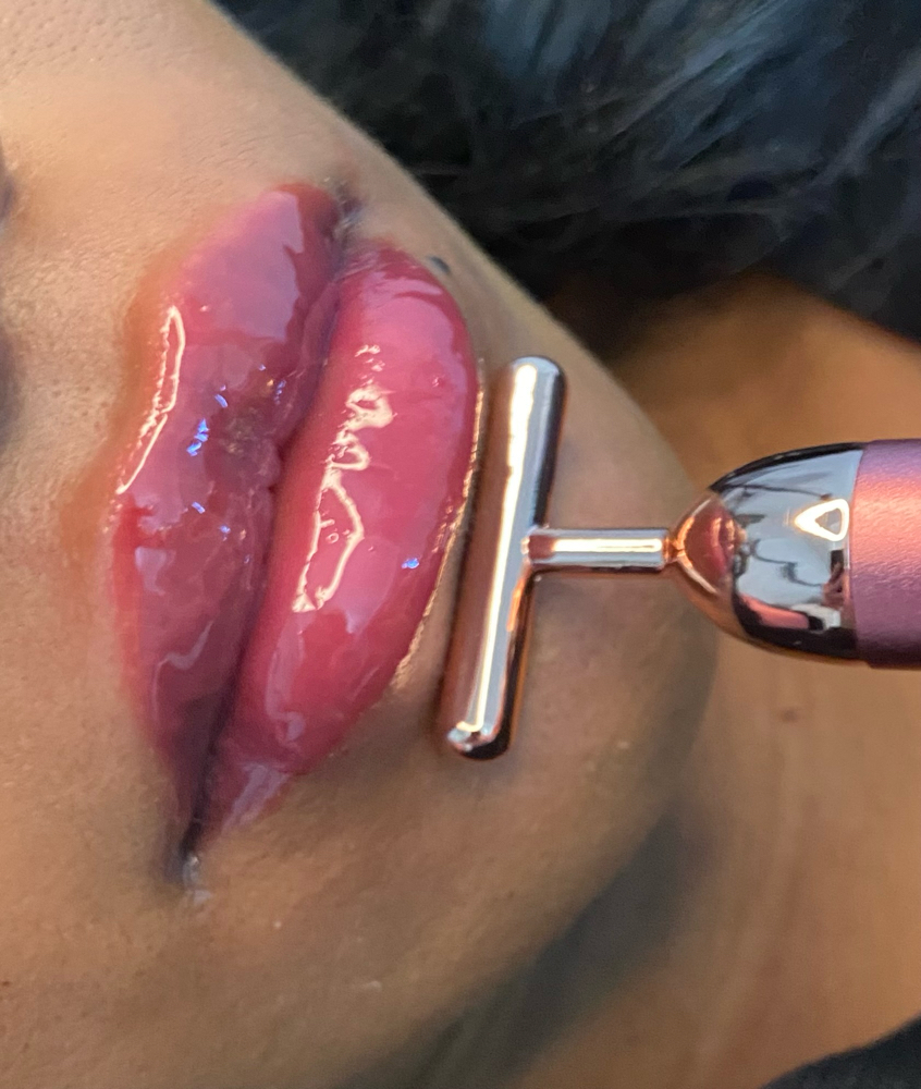 NEEDLESS Lip Filler