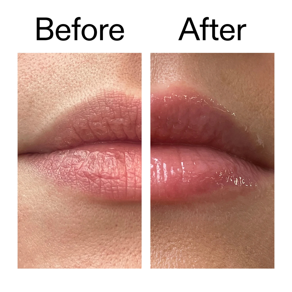 Lip Treatment at Luma Beauty in Lexington, KY