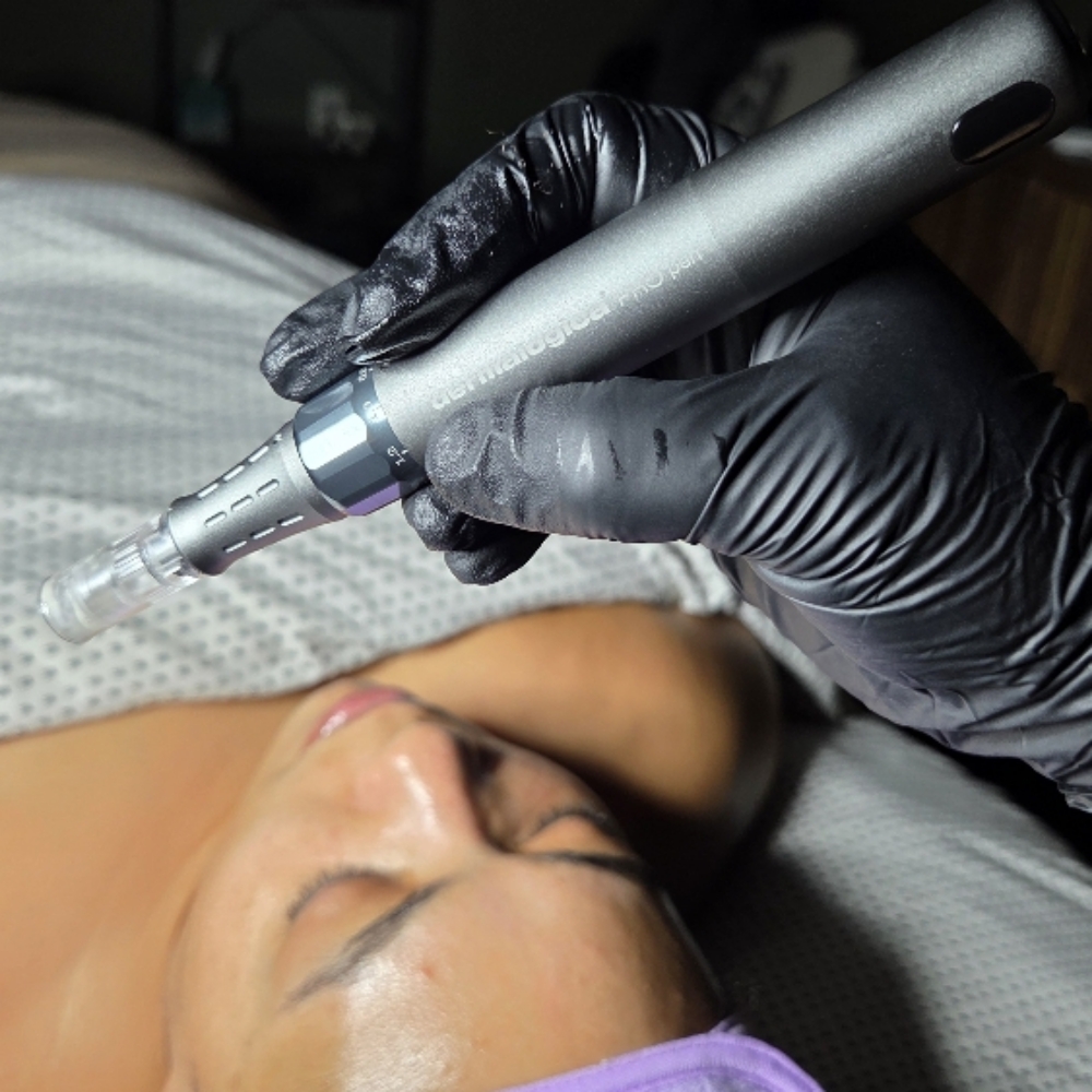 PDRN Nano Infusion Facial at Glow Loft in North Haven, CT