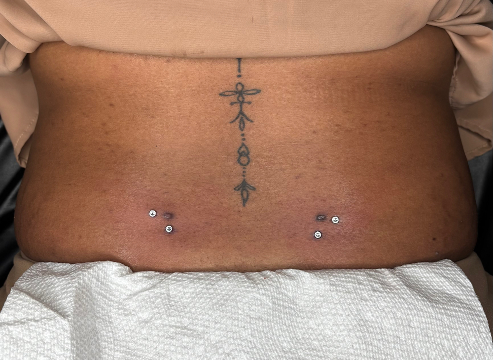 Surface Back Piercings at Piercingtings in Jacksonville, FL