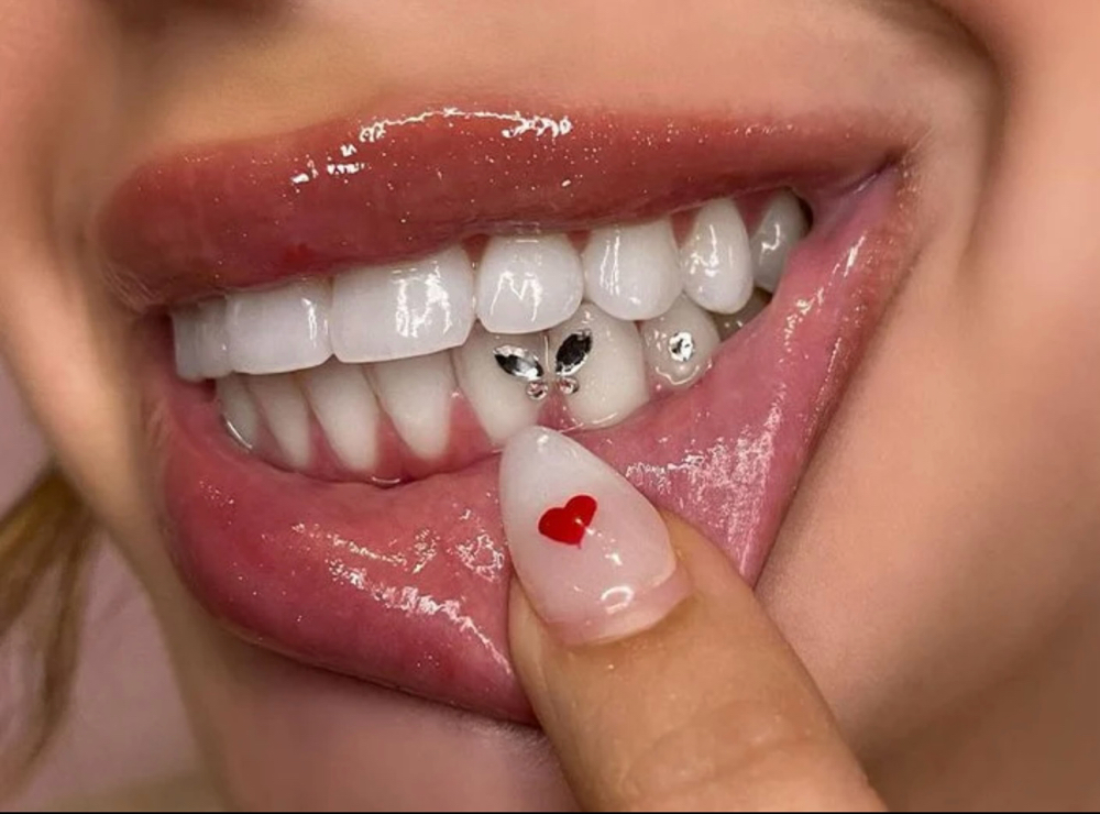 Galentine’s Day Tooth Gems